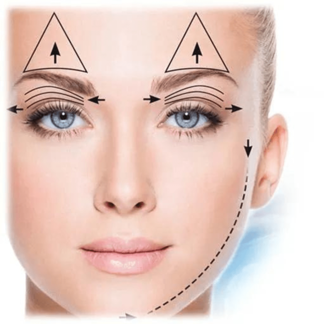 Medical Jet Plasma Lift