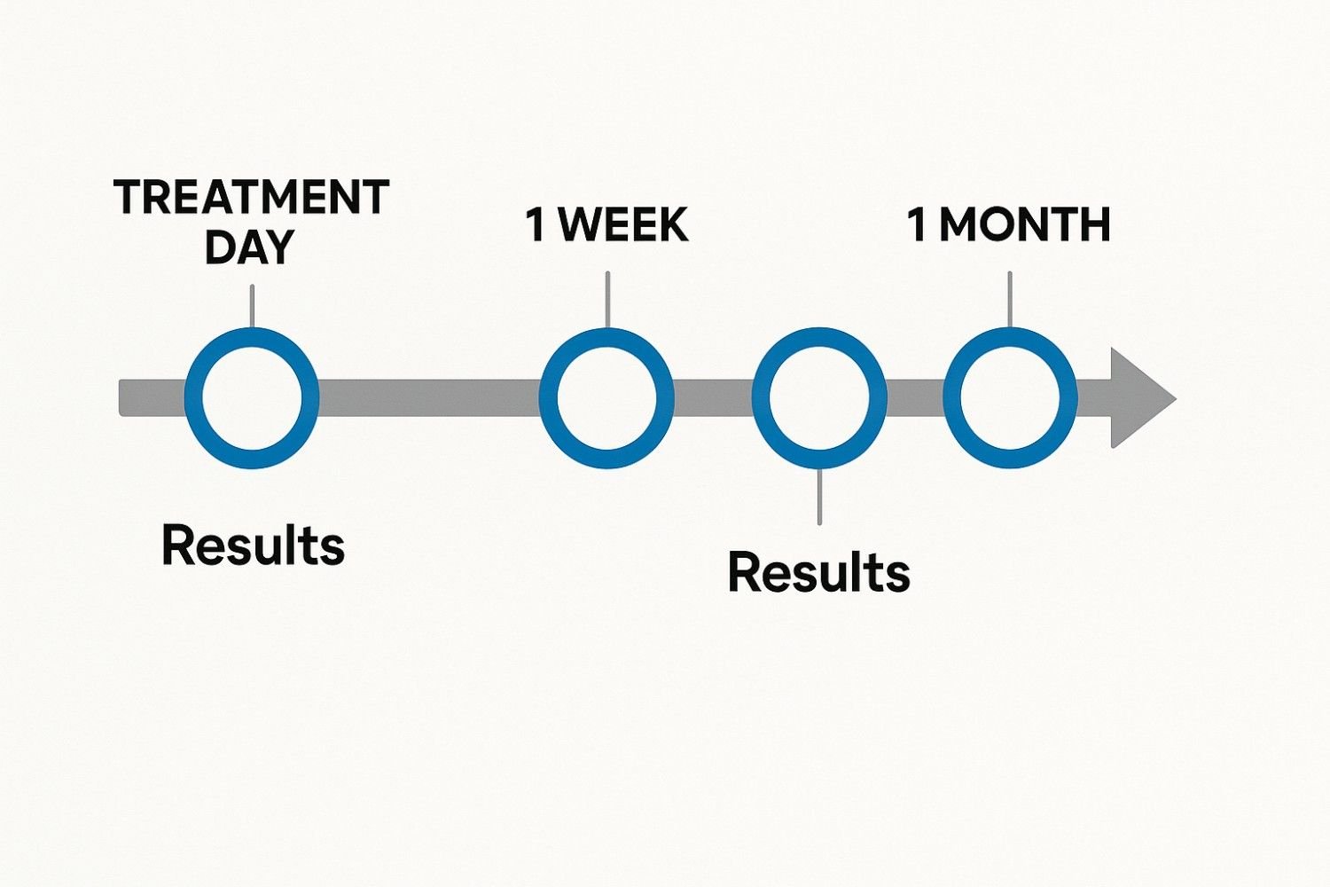 Visual timeline showing Botox platysmal bands treatment results progression over six months