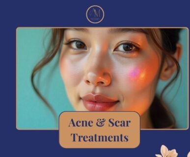 Professional acne scar treatment results at AM Aesthetics medical clinic